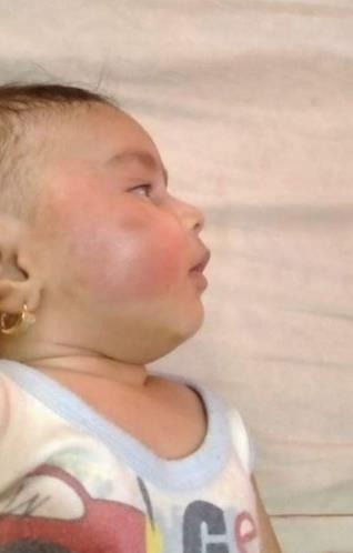 وحشية أب مصري.. عذب رضيعة وكسر أطرافها لرفضه إنجاب الإناث