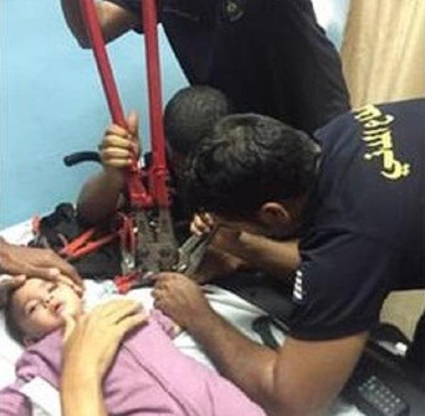 مدني المدينة يستخرج يد طفل محتجزه داخل صافرة قدر الضغط