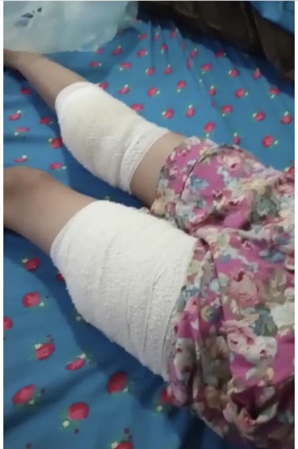 الاعتداء على طفلة بجازان