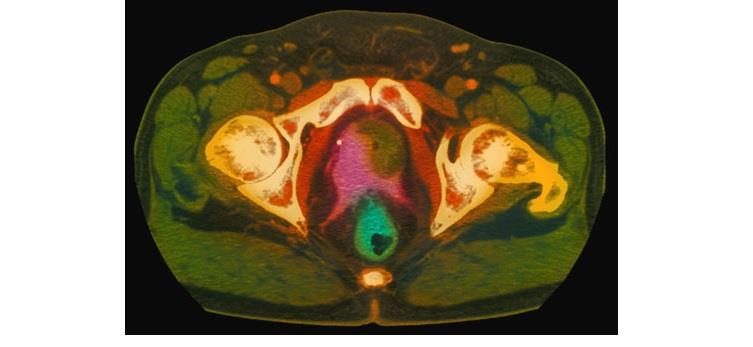 التصوير بالرنين المغناطيسي التصوير بالرنين المغناطيسي