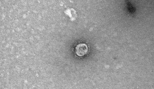 صور جديدة لفايروس 