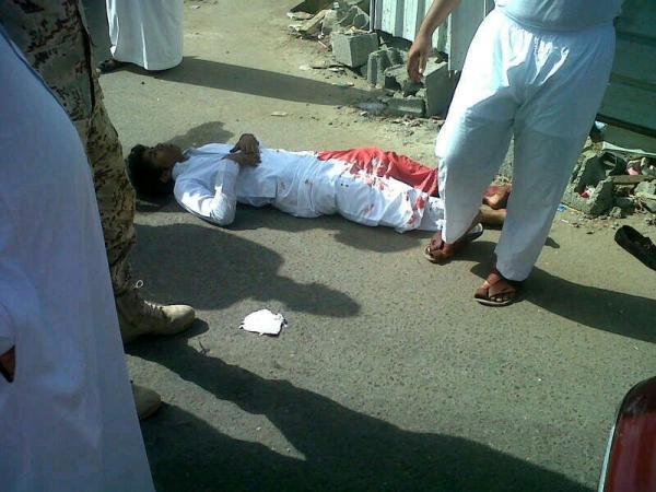 الطالب المصاب 