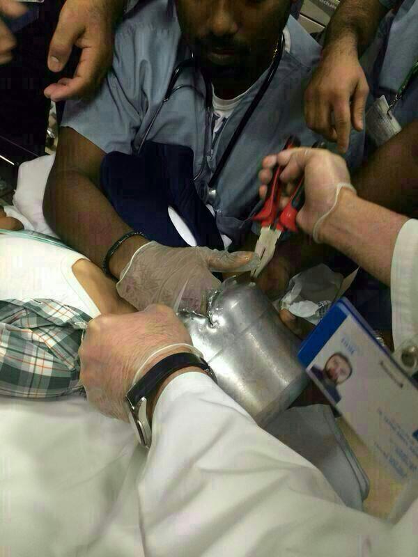  اخراج رأس طفل من قدر ضغط 