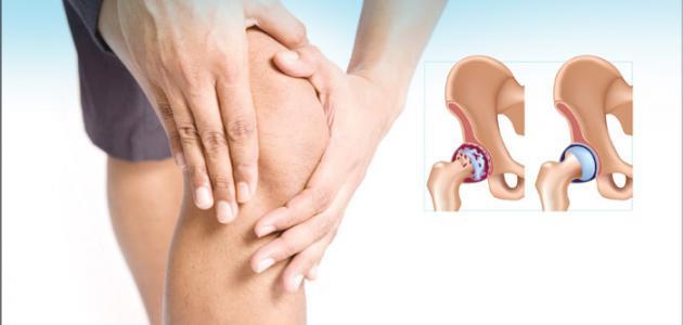 الام العظام الام العظام