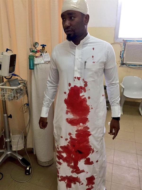 بعد عدة حوادث مشابهة.. طالب يشج رأس معلم بعصا غليظة ويسبب له إصابة بليغة بالباحة (صورة)