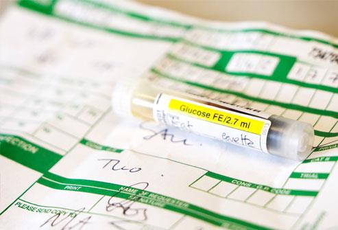 فحص مستويات الكوليسترول فحص مستويات الكوليسترول