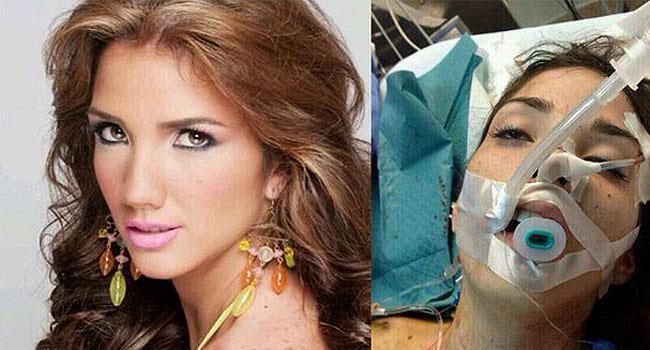 أصيبت كارمونا بطلق ناري في رأسها خلال مشاركتها في الاحتجاجات