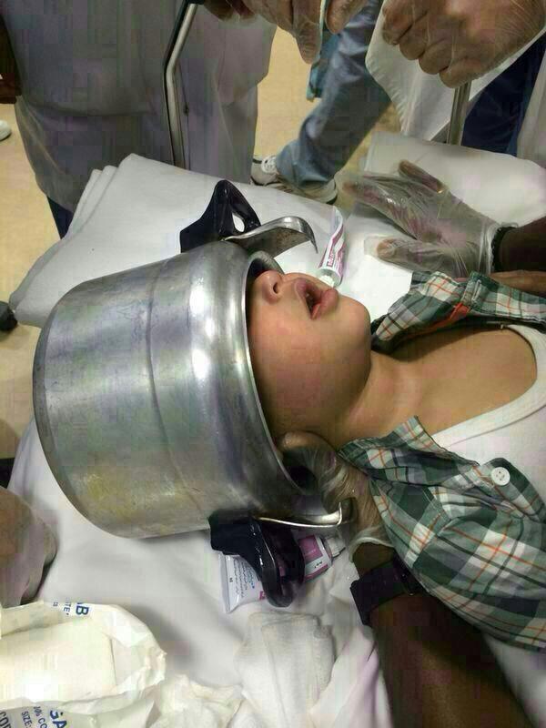  اخراج رأس طفل من قدر ضغط 