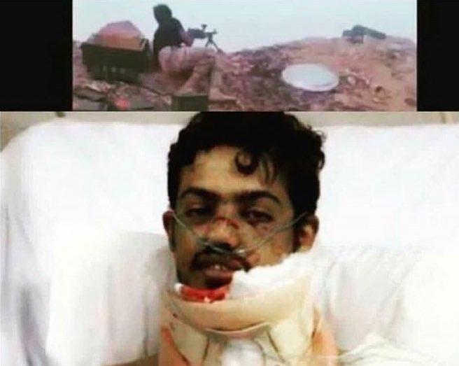 إصابة جندي قطري خلال تصديه لهجوم لمليشيا الحوثي وقتله عدداً منهم بالحد الجنوبي إصابة جندي قطري خلال تصديه لهجوم لمليشيا الحوثي وقتله عدداً منهم بالحد الجنوبي