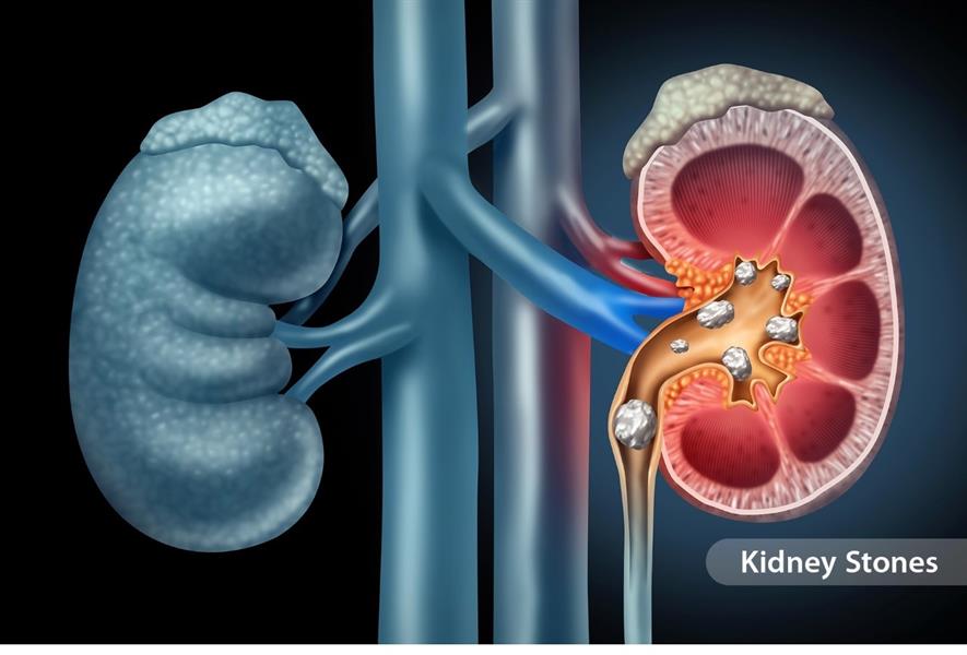 غائم أو أبيض 