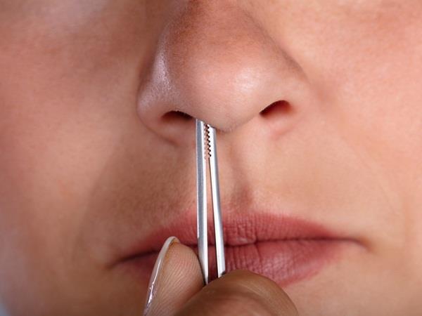 إزالة شعر الأنف