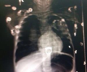 صورة الاشعة