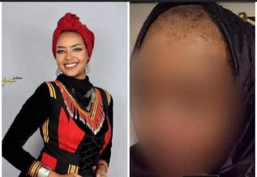 جرائم مروعة ارتكبتها مليشيا الحوثي ضد نساء اليمن