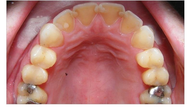 تطورات سلبية 