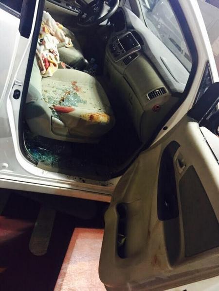  مجهول يصيب موظف 