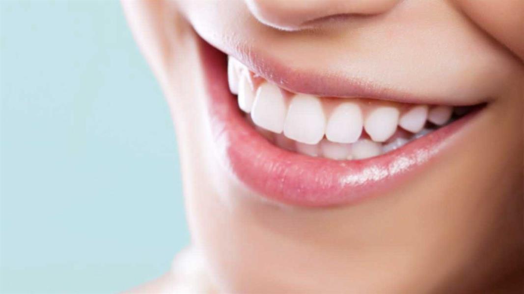 10 علامات تعني وجود مشكلة في الأسنان