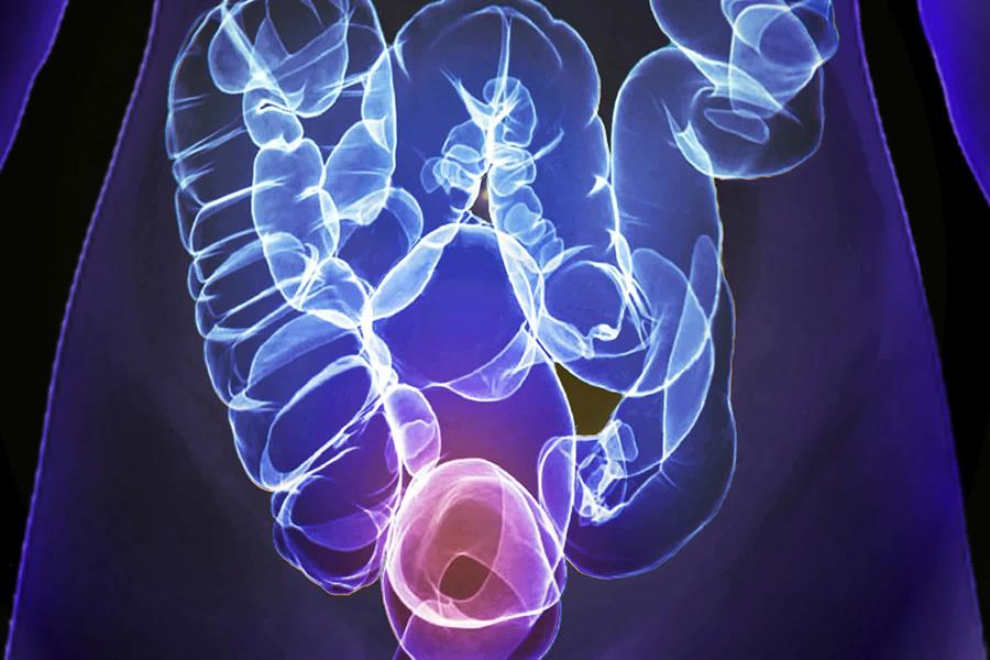  الأشعة المقطعية