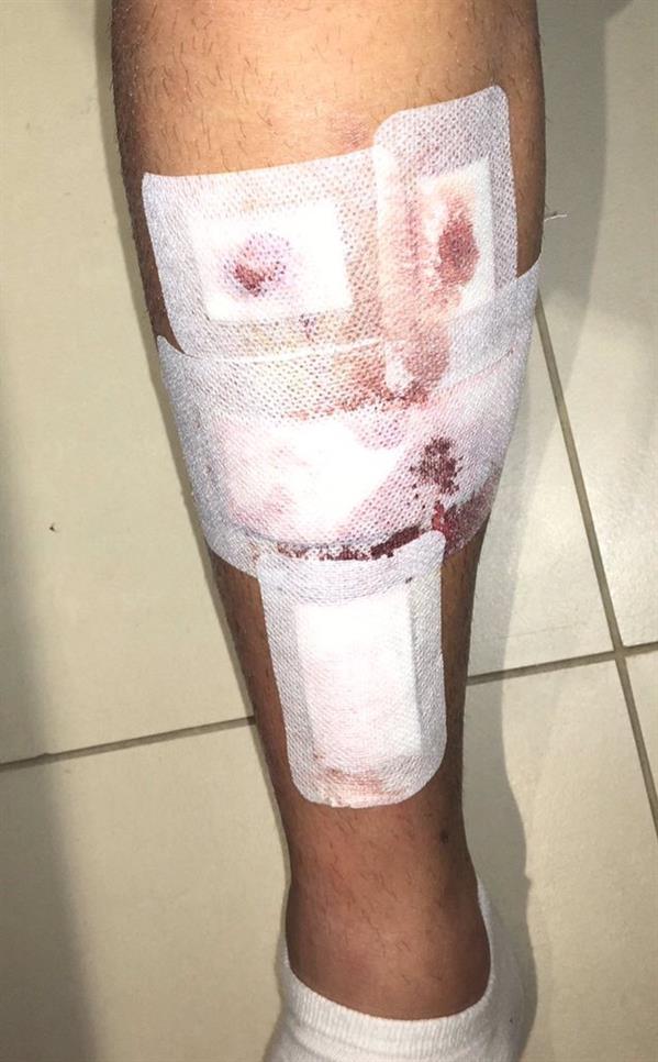 نيكولاس ميليسي نيكولاس ميليسي