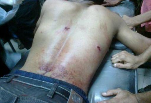 الحراك الجنوبي والشرطة في عدن جنوب اليمن