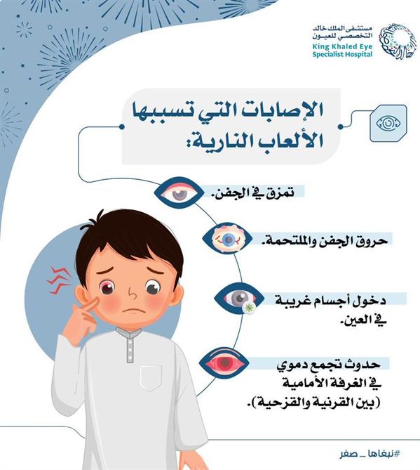 مخاطر الألعاب النارية على أعيُن الأطفال 