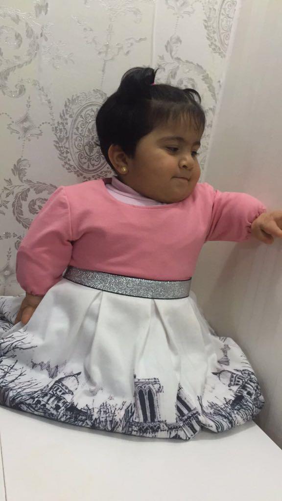 وُلدت دون قدمين وبأطراف مشوّهة.. الطفلة 