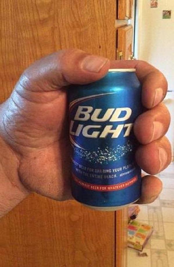 أمريكي يمتلك يدًا ضخمة تشبه يد شخصية باباي الكرتونية- صور