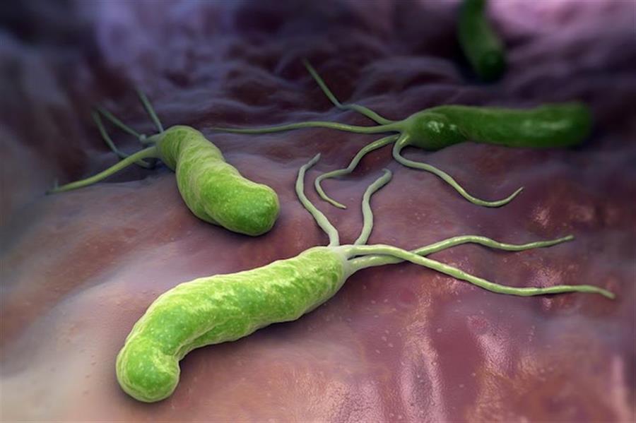 جرثومة المعدة جرثومة المعدة