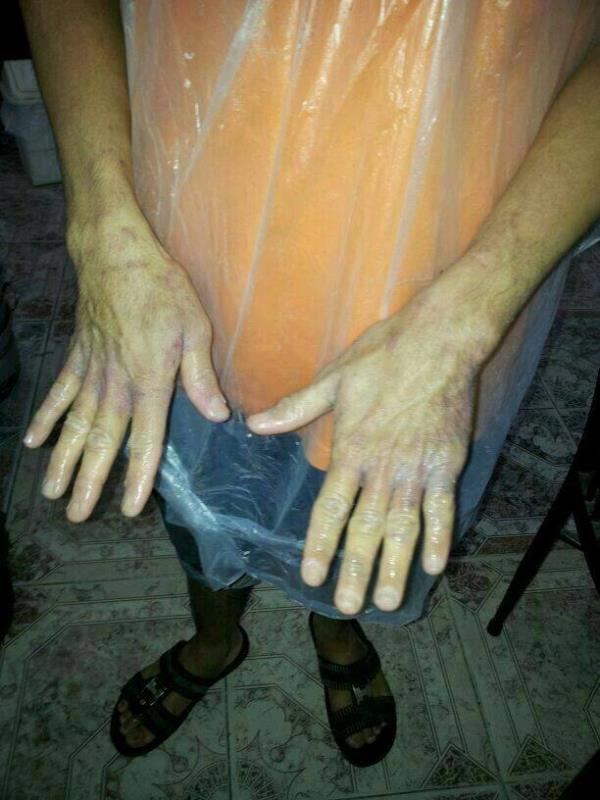 مصادر337 كجم من اللحوم الفاسدة 