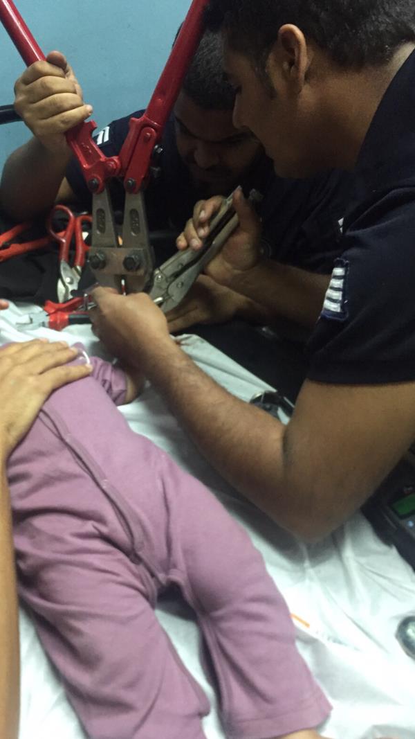 مدني المدينة يستخرج يد طفل محتجزه داخل صافرة قدر الضغط