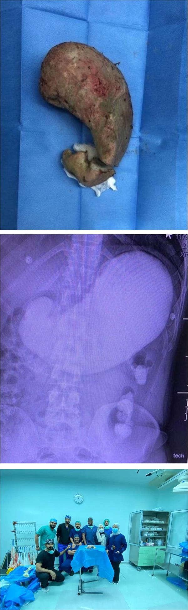 مقيم بجدة يحاول الانتحار بابتلاع خليط أسمنتي مقيم بجدة يحاول الانتحار بابتلاع خليط أسمنتي