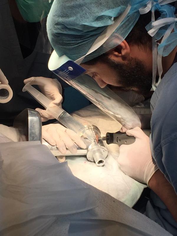 مدني جدة يحرر يد طفل من فرامة لحم داخل غرفة العمليات