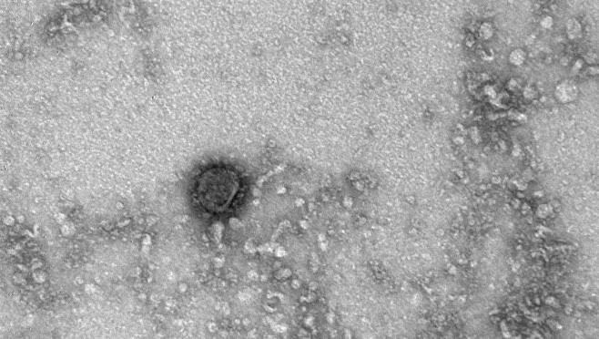 صور جديدة لفايروس 