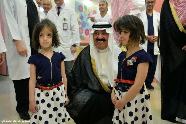 بالصور.. التوأم السيامي السعودي بالصور.. التوأم السيامي السعودي