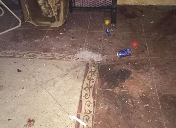 جازان: قنبلة يدوية تقتل طفلاً وتصيب طفلين آخرين بعد محاولتهم العبث بها