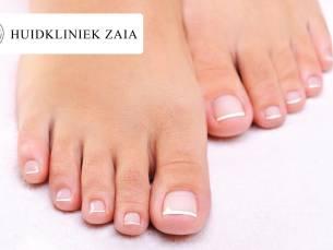 1 of 3 kalknagelbehandelingen voor 10 nagels inclusief manicurebehandeling