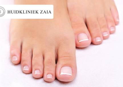 1 of 3 kalknagelbehandelingen voor 10 nagels inclusief manicurebehandeling