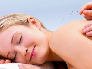 Acupunctuur (45 min)