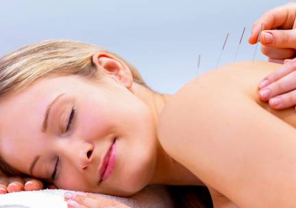 Acupunctuur (45 min)
