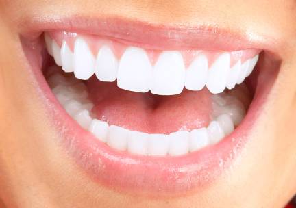 Tandenbleekbehandeling(en)