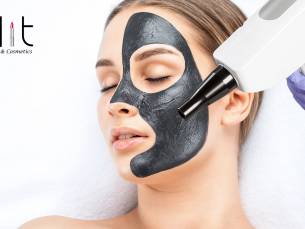 Carbon laser peeling-behandeling