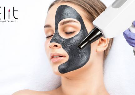 Carbon laser peeling-behandeling