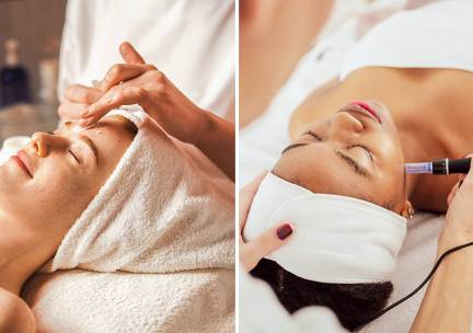 Gezichtsbehandeling of microneedling (60 min)