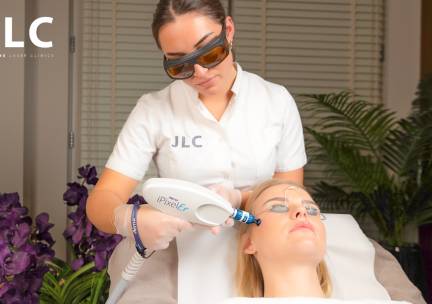 Laserbehandeling voor gelaatszone naar keuze