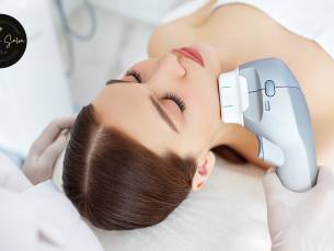 HIFU facelift-behandeling