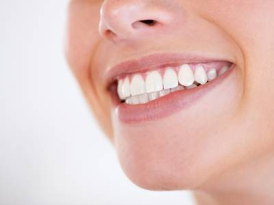 Tandenbleekbehandeling(en)