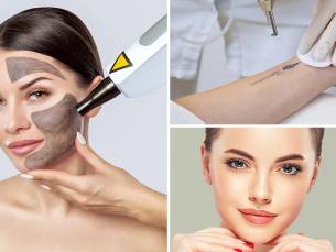 Carbon laser peeling, PMU verwijderen of tattoo verwijderen