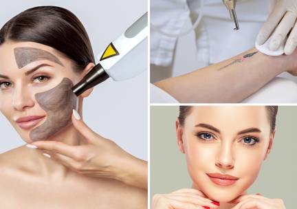 Carbon laser peeling, PMU verwijderen of tattoo verwijderen