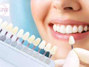 Tandenbleekbehandeling(en) (20 min)