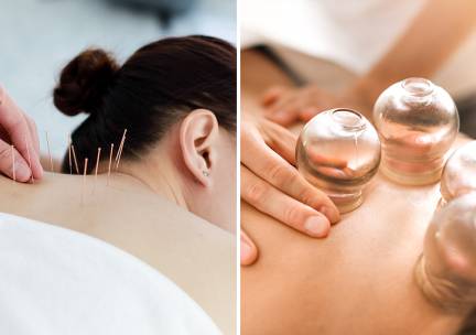 Cuppingmassage of 1, 3 of 5 acupunctuurbehandeling(en)