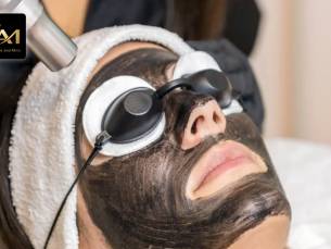 1, 3 of 5 carbon laserbehandeling(en) voor gezicht en/of hals